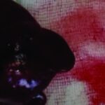 【病例】幸运！犬泌尿系统检查时偶然发现了肝癌，肿瘤切除手术后预后如何？