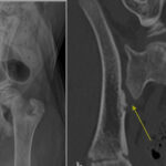 【病例】伯恩山犬的“背痛”之谜：非化脓性侵蚀性骶髂关节炎的1.5年追踪