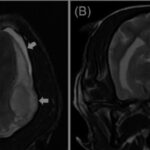 【病例】4岁博美突发“脑出血”！医生却说不是撞的？真相让人心疼……