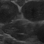 【病例】容易误诊为淋巴瘤的另一个隐形杀手：一只迷你雪纳瑞的感染警示录